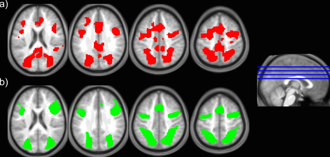 fmri attention and decision making